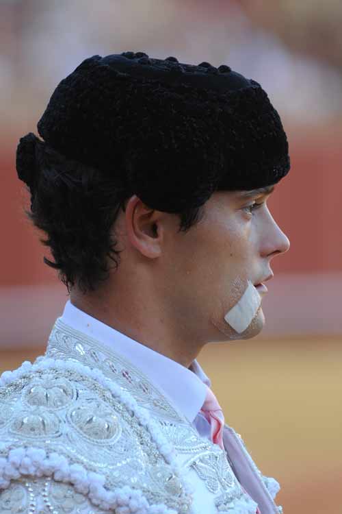 Miguel Abellán aún mantiene algún apósito tras la cornada en la boca de Madrid. (FOTO: Matito)