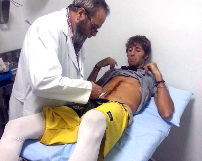 Manuel Escribano, que mantiene vendas elásticas en sus dos piernas para ayudar a evitar trombos circulatorios, ha visitado hoy en Sevilla al doctor Domingo Jiménez, que le ha retirado los 35 puntos que parten su abdomen en dos mitades.