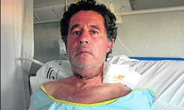 La impactante imagen de José Antonio Campuzano en el hospital, con el cuello seccionado de lado a lado y la mandíbula superior muy hinchada. (FOTO: Diario de Sevilla)